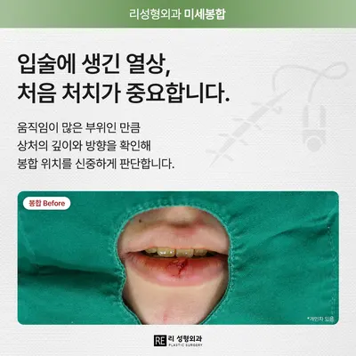 리성형외과의원 — 업체가 네이버 플레이스에 올린 사진 2