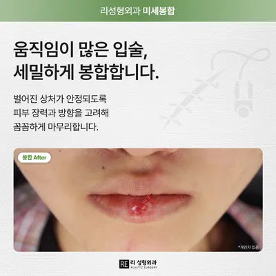 리성형외과의원 — 업체가 네이버 플레이스에 올린 사진 3