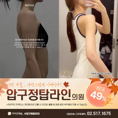 압구정탑라인의원 — 업체가 네이버 플레이스에 올린 사진 2
