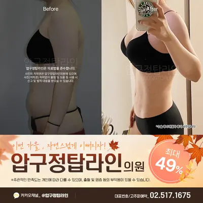 압구정탑라인의원 — 업체가 네이버 플레이스에 올린 사진 3