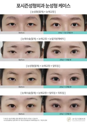 포시즌성형외과의원 — 업체가 네이버 플레이스에 올린 사진 2
