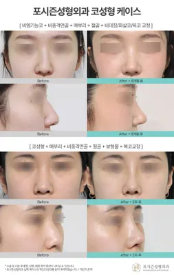 포시즌성형외과의원 — 업체가 네이버 플레이스에 올린 사진 3