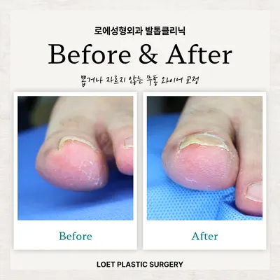 로에성형외과의원 — 업체가 네이버 플레이스에 올린 사진 3