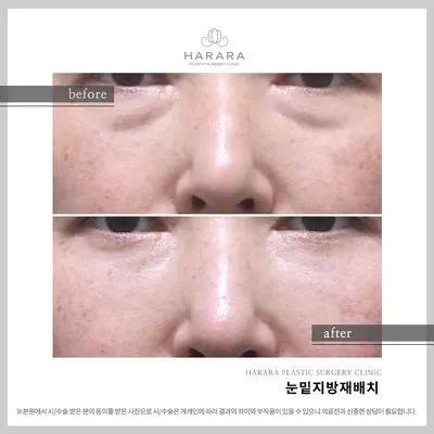 하라라성형외과의원 — 업체가 네이버 플레이스에 올린 사진 1