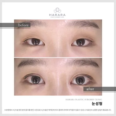 하라라성형외과의원 — 업체가 네이버 플레이스에 올린 사진 2