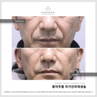 하라라성형외과의원 — 업체가 네이버 플레이스에 올린 사진 3