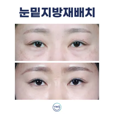 예스성형외과의원 — 업체가 네이버 플레이스에 올린 사진 2