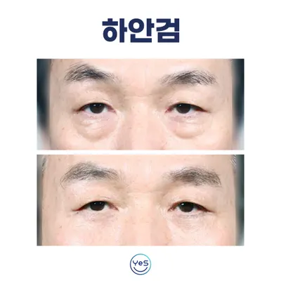 예스성형외과의원 — 업체가 네이버 플레이스에 올린 사진 3