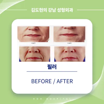 김도현의강남성형외과의원 — 업체가 네이버 플레이스에 올린 사진 3