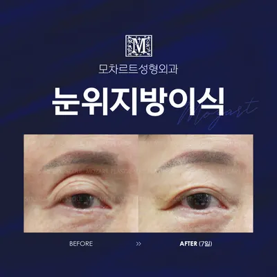 모차르트성형외과의원 — 업체가 네이버 플레이스에 올린 사진 2