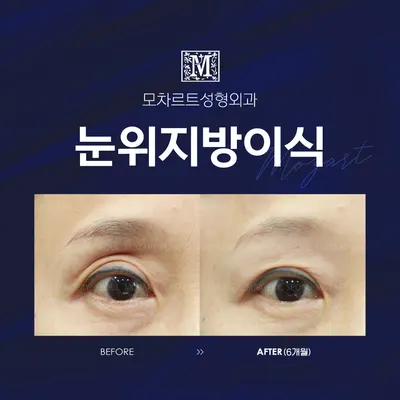 모차르트성형외과의원 — 업체가 네이버 플레이스에 올린 사진 3