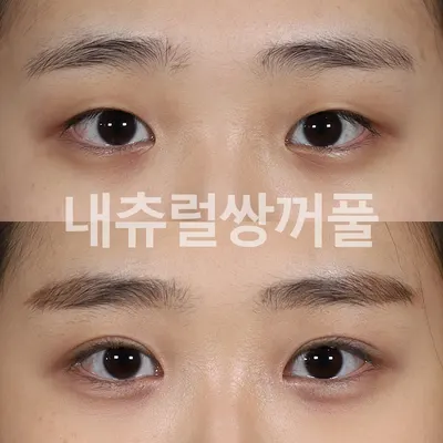 청담이지성형외과의원 — 업체가 네이버 플레이스에 올린 사진 2