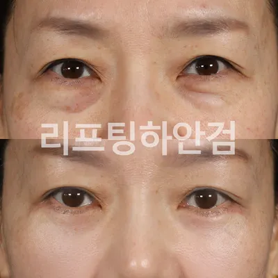 청담이지성형외과의원 — 업체가 네이버 플레이스에 올린 사진 3